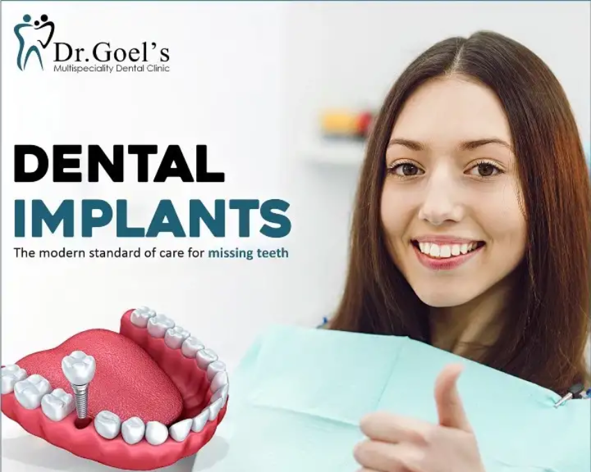 Best Dental Implant Clinic in Gurugram