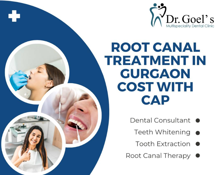 Root Canal Treatment Cost With Cap