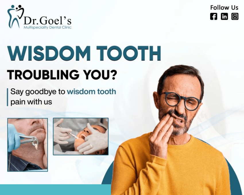 Wisdom Tooth Removal at Dental Clinics in Gurgaon