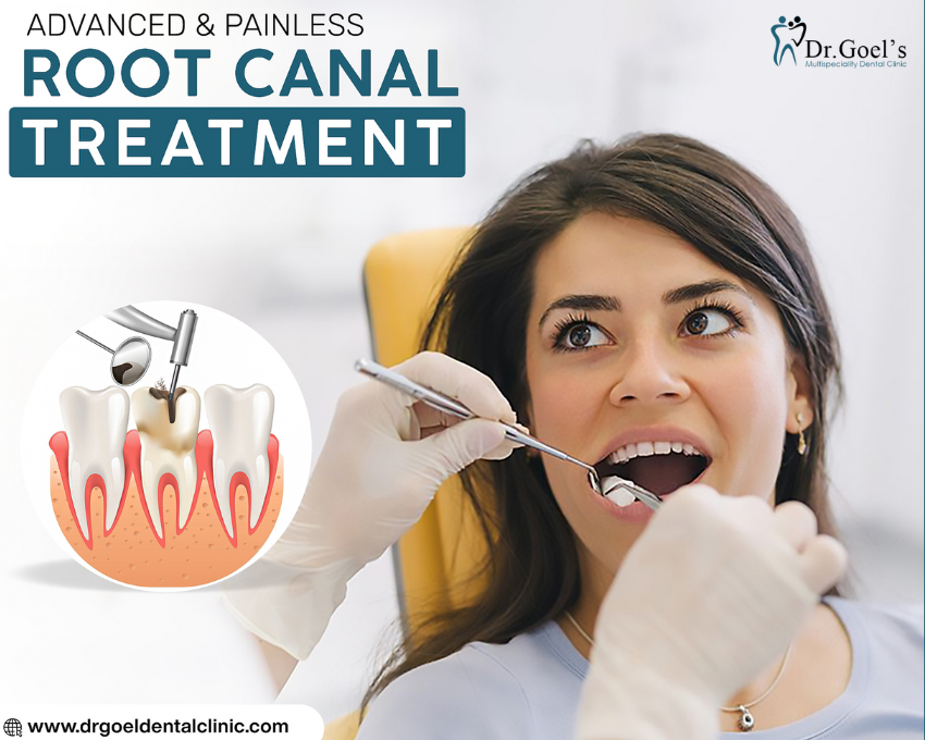 7 Tell-tale Signs that tells you need a Root Canal Treatment