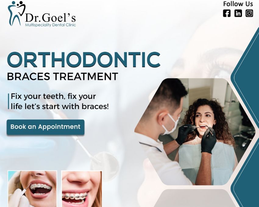 5 Benefits of Choosing the Best Orthodontics in Gurgaon