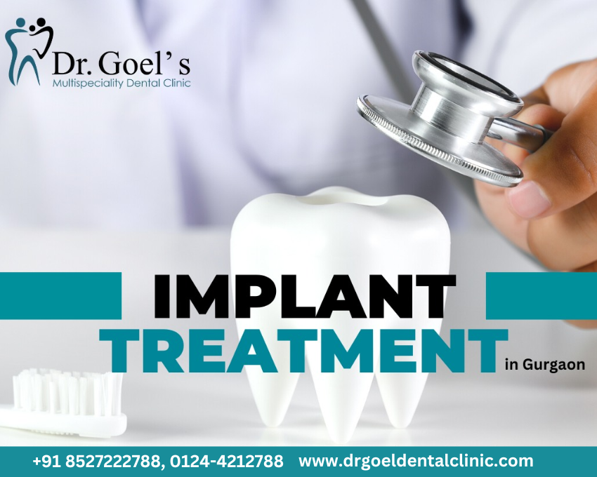 Best Dental Implant Clinic in Gurgaon