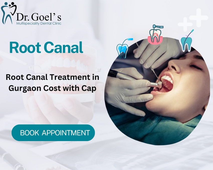 Do I need a Dental Crown After A Root Canal Treatment?